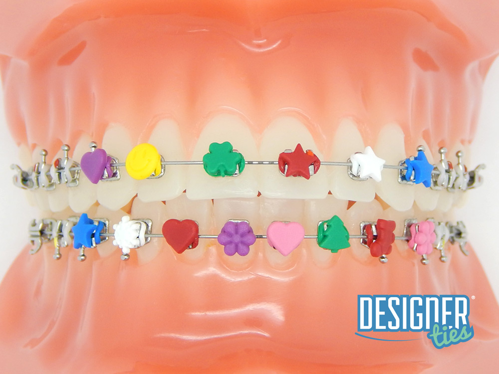 Красивые резиночки для брекетов signal зубная паста официальный сайт