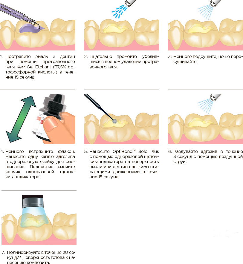 Адгезив 5 поколения OptiBond Solo Plus